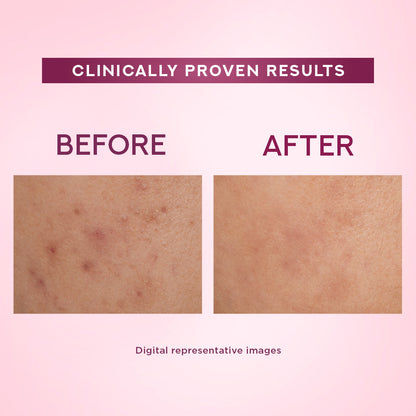 Ponds Bright Beauty Spot-Less Fairness Day Cream 23 g