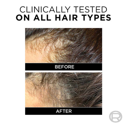 L'Oreal Paris Fall Repair Shampoo 360 ml