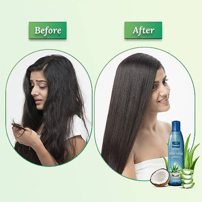 Parachute Advance Aloevera Hair Oil 400ml