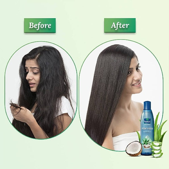 Parachute Advance Aloevera Hair Oil 400ml