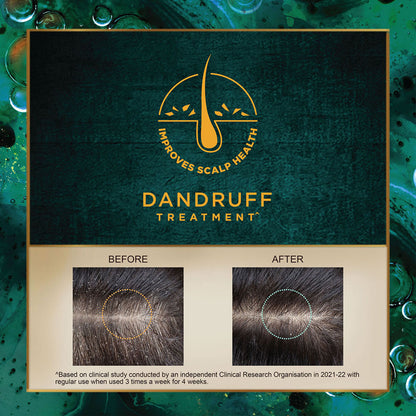 Indulekha Svetakutaja Anti Dandruff Hair Oil 100 ml
