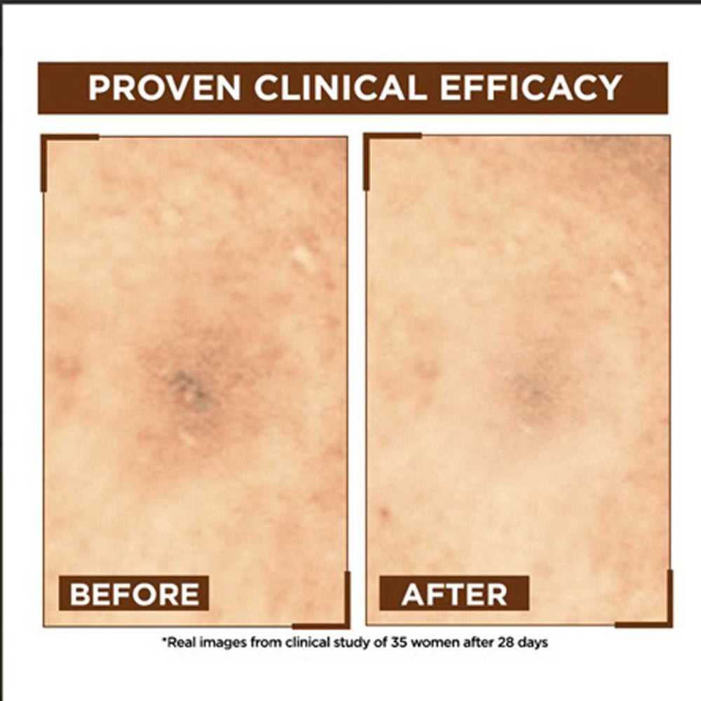 Garnier Bright Complete Night Vitamin C Serum 30 ml