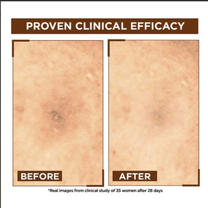 Garnier Bright Complete Night Vitamin C Serum 30 ml